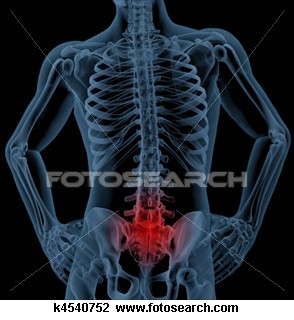 Gambaran posisi cedera Tulang Belakang